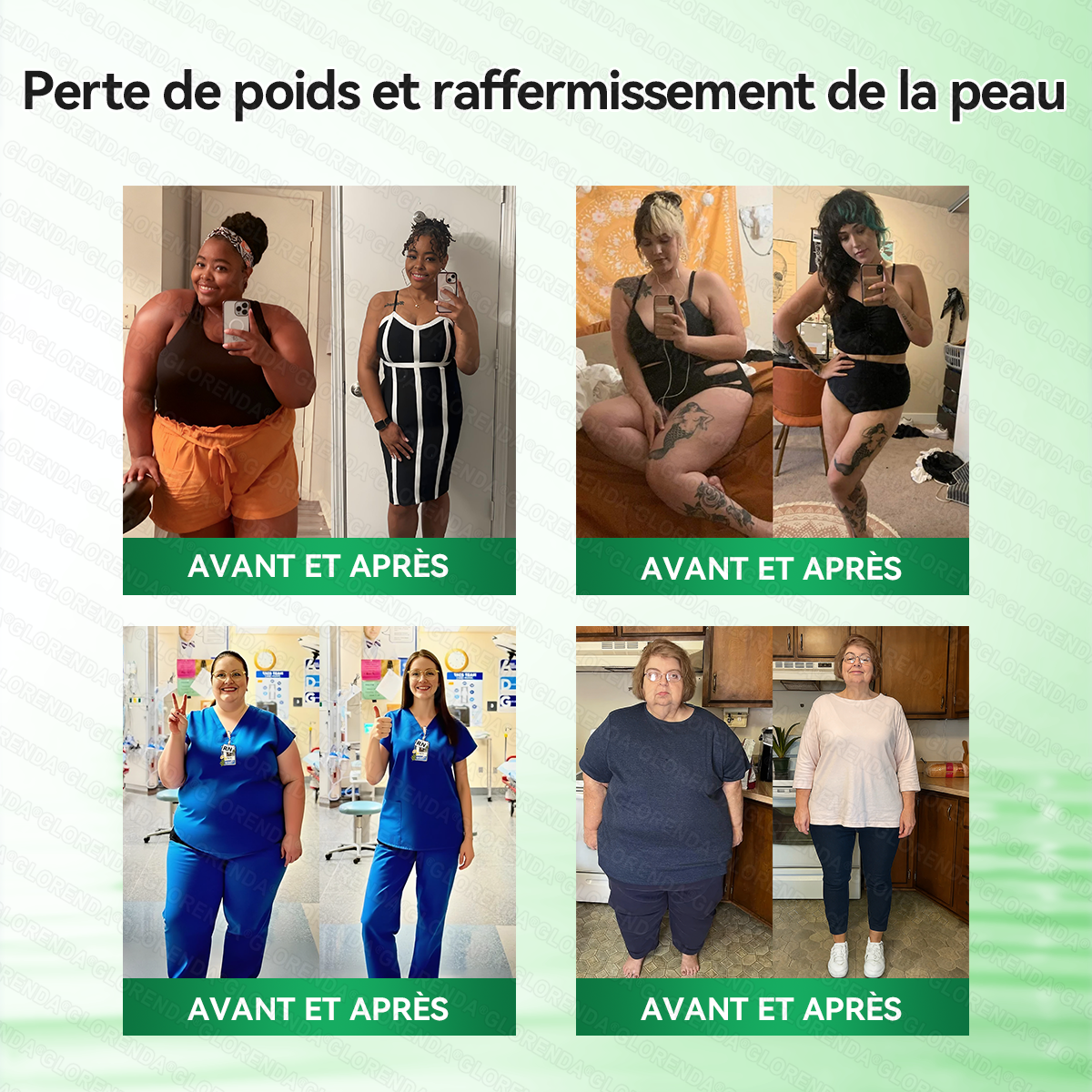 Boutique officielle 💐 𝐆𝐋𝐎𝐑𝐄𝐍𝐃𝐀® Moringa · Berbérine + NAD+ – Patch Microneedle Nano Avancé 10-en-1 (1×/jour, résultats visibles en 7 jours) | Obésité, relâchement cutané, apnée du sommeil, articulations, etc.